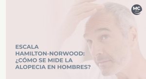 Escala Hamilton-Norwood: ¿Cómo mide la alopecia en hombres?
