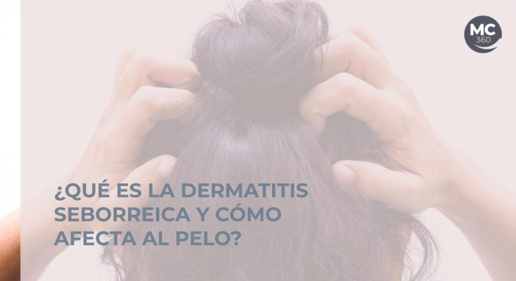 Dermatitis seborreica en el pelo