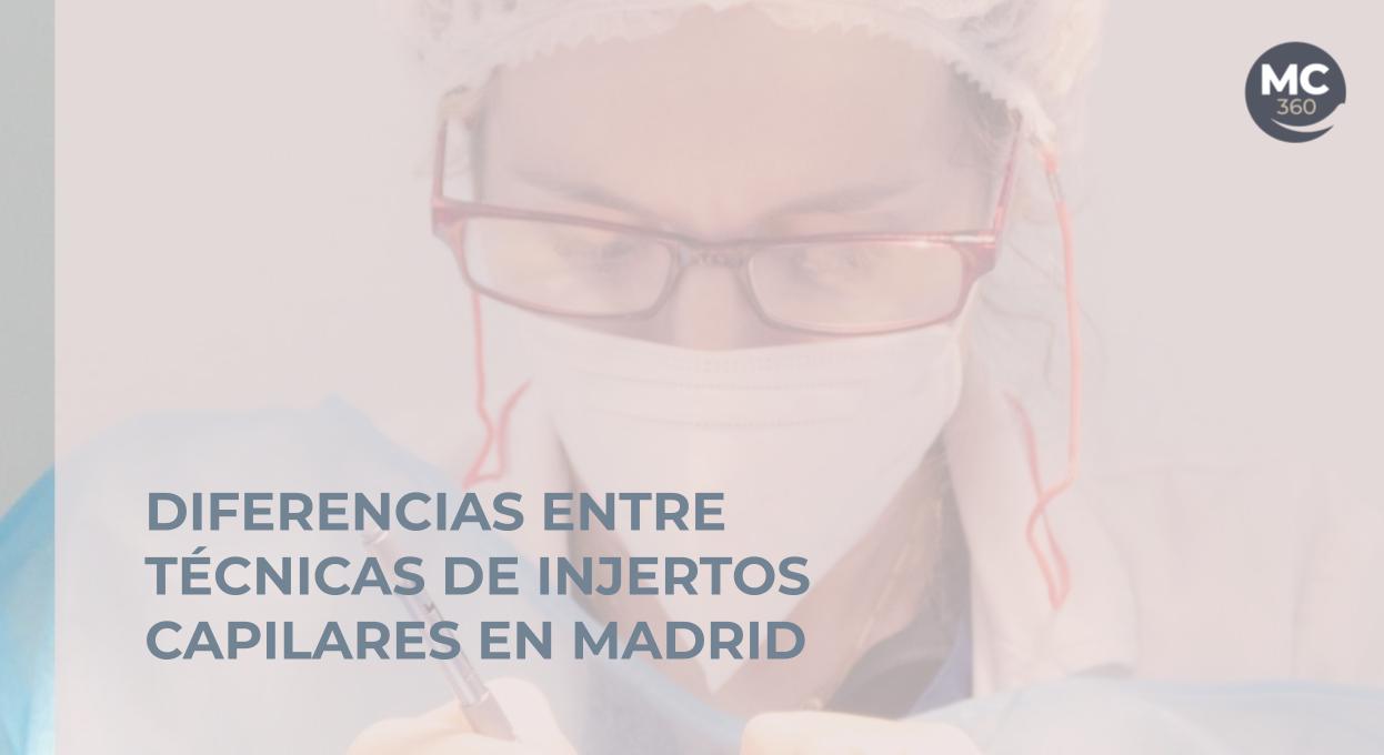 Diferencias entre técnicas de injertos capilares en Madrid