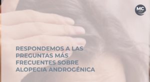 Alopecia androgénica en mujeres: Desafíos y tratamientos en nuestra clínica capilar