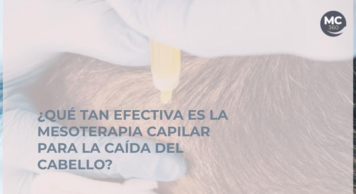 Eficacia de la mesoterapia capilar para la caída del cabello