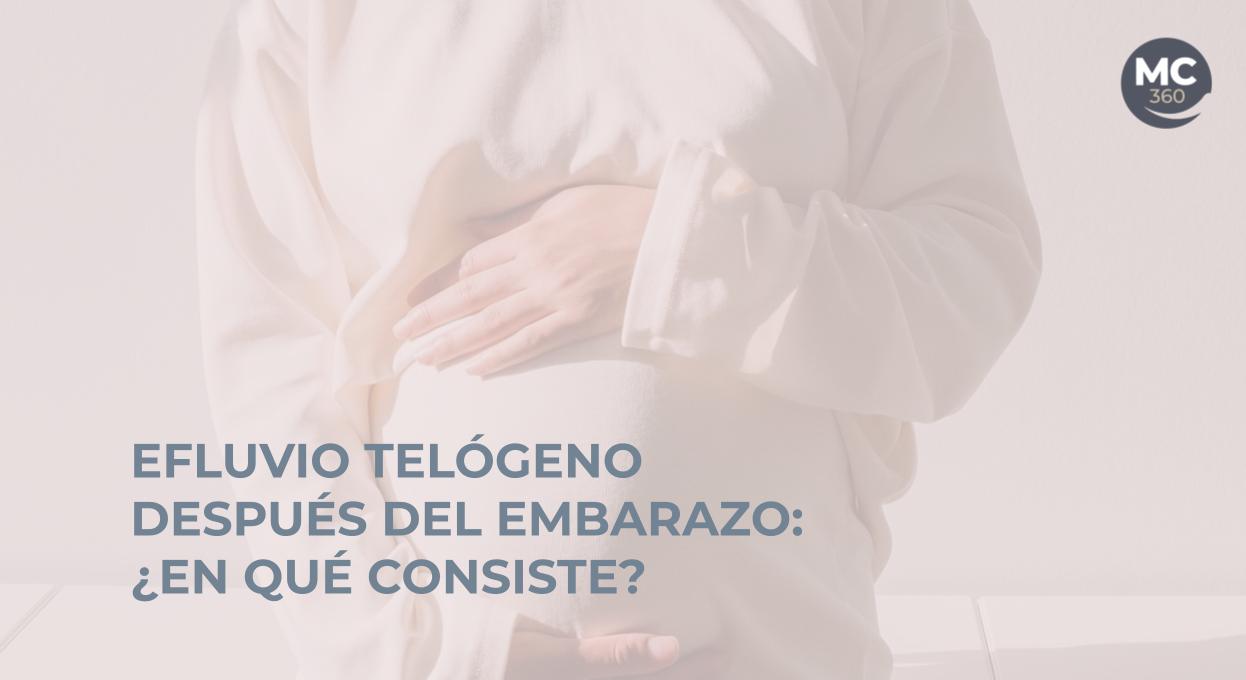 Efluvio telógeno después del embarazo