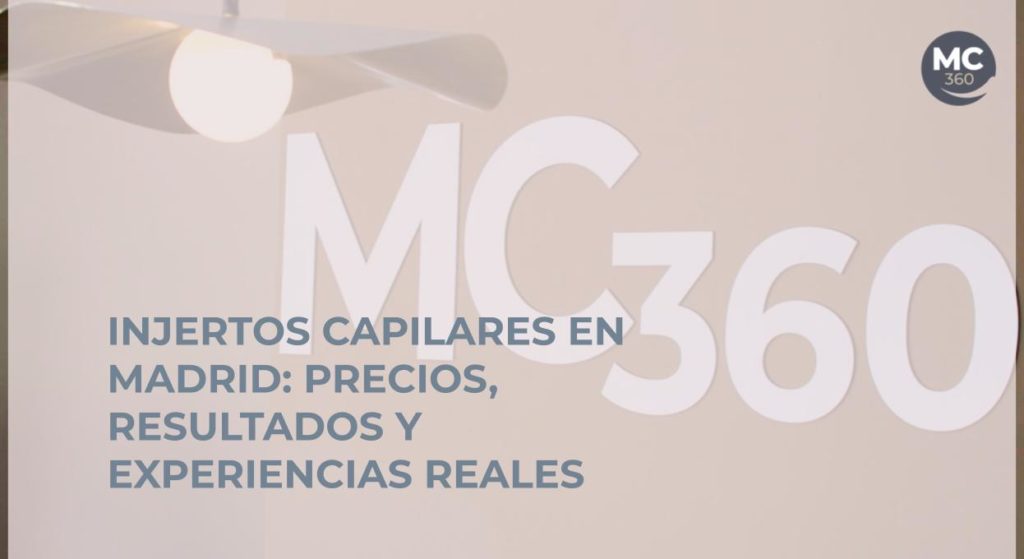 Injertos capilares en Madrid: Precios, resultados y experiencias reales