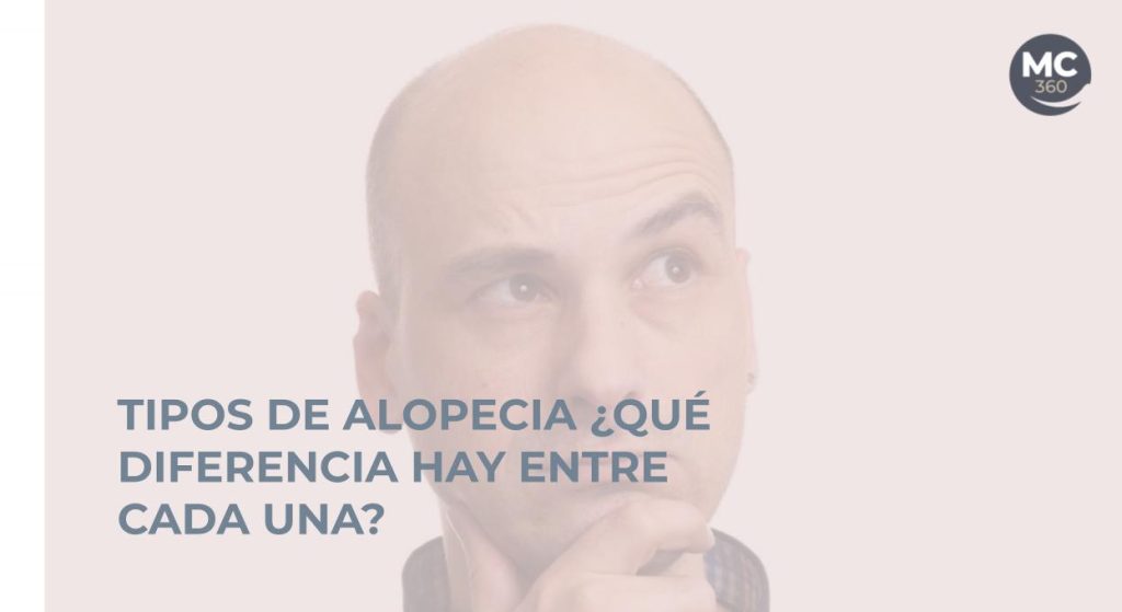 Tipos alopecia