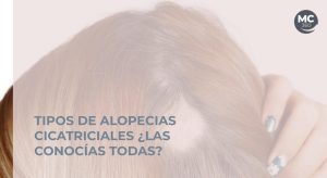 Tipos alopecias cicatriciales